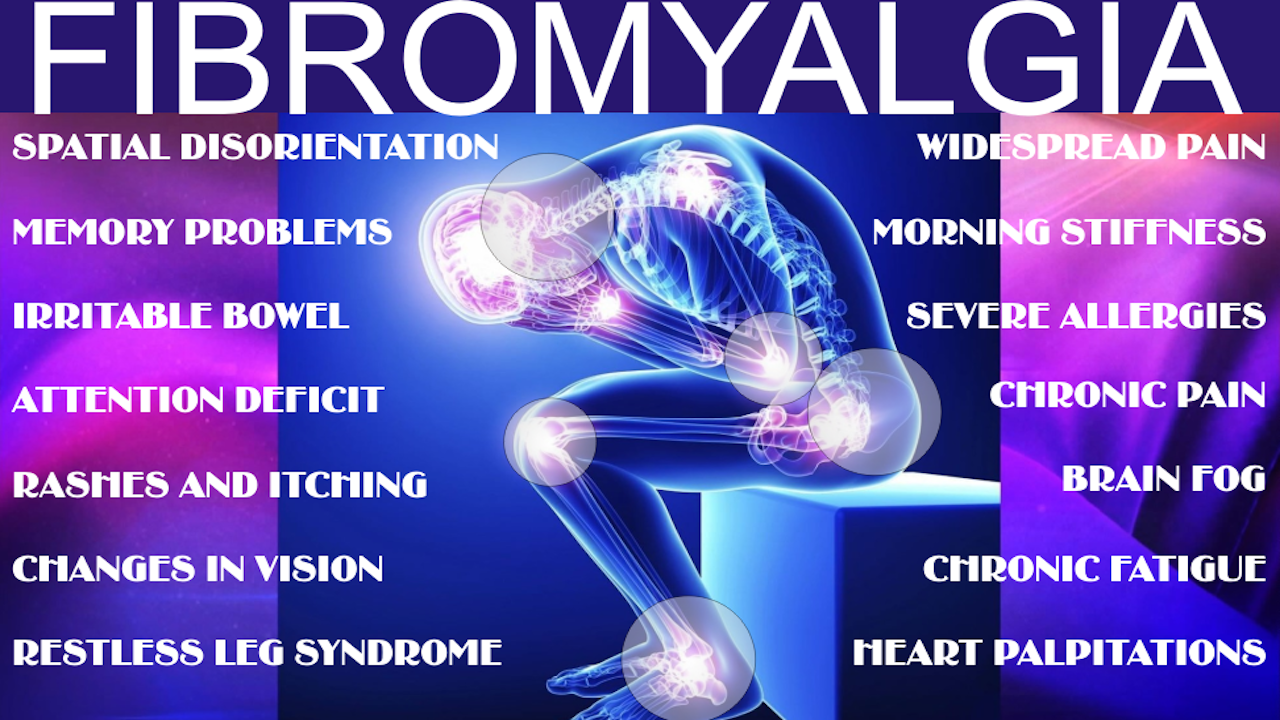 Managing Fibromyalgia: New Insights and Effective Strategies